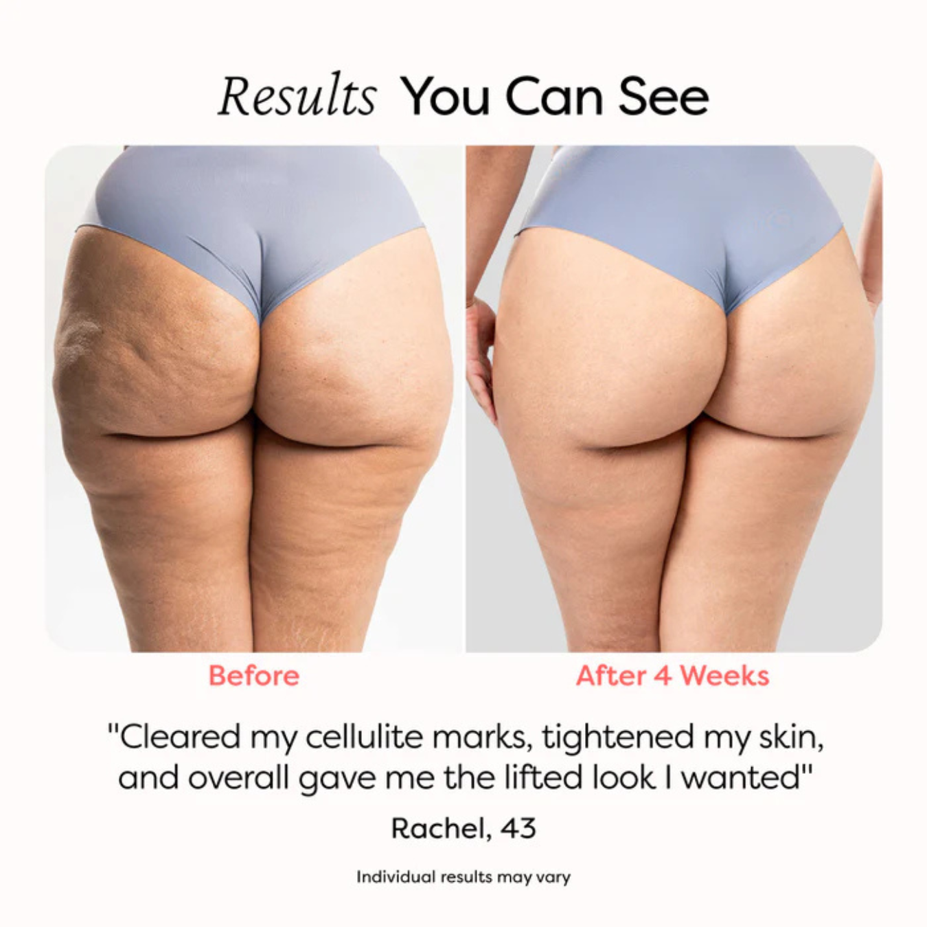 SculptCura™ Body Sculpt